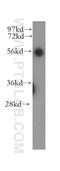 Ubiquitin Associated Protein 1 antibody, 12385-1-AP, Proteintech Group, Western Blot image 