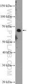 GLIS Family Zinc Finger 1 antibody, 23138-1-AP, Proteintech Group, Western Blot image 