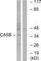 Carbonic Anhydrase 5B antibody, abx014313, Abbexa, Western Blot image 