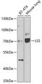 Lanosterol synthase antibody, A01431, Boster Biological Technology, Western Blot image 