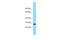 Ferritin Mitochondrial antibody, A09117, Boster Biological Technology, Western Blot image 