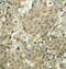 CFL1 antibody, LS-C335845, Lifespan Biosciences, Immunohistochemistry paraffin image 