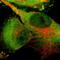 Glycogen Phosphorylase L antibody, NBP1-86182, Novus Biologicals, Immunocytochemistry image 