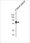 Alpha-1-antitrypsin antibody, 63-942, ProSci, Western Blot image 