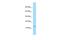 INSSA1 antibody, A17780, Boster Biological Technology, Western Blot image 