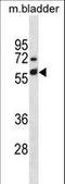 Keratin 6A antibody, LS-C157919, Lifespan Biosciences, Western Blot image 