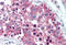 Interleukin 20 Receptor Subunit Alpha antibody, MBS241847, MyBioSource, Immunohistochemistry frozen image 