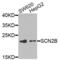 Sodium Voltage-Gated Channel Beta Subunit 2 antibody, PA5-76248, Invitrogen Antibodies, Western Blot image 