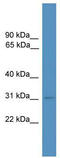 Methyl-CpG Binding Domain Protein 3 antibody, TA345665, Origene, Western Blot image 