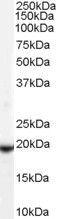 Phospholipid hydroperoxide glutathione peroxidase, mitochondrial antibody, GTX89281, GeneTex, Western Blot image 