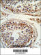 Integrin Subunit Beta 3 antibody, 63-581, ProSci, Immunohistochemistry paraffin image 