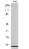 Interferon Induced Transmembrane Protein 3 antibody, STJ93642, St John