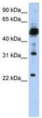 Transmembrane Protein 38B antibody, TA342357, Origene, Western Blot image 