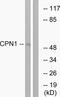 Carboxypeptidase N Subunit 1 antibody, A30597, Boster Biological Technology, Western Blot image 