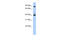 Cyclin Dependent Kinase 9 antibody, AVARP03004_P050, Aviva Systems Biology, Western Blot image 