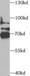 Synaptotagmin Binding Cytoplasmic RNA Interacting Protein antibody, FNab08434, FineTest, Western Blot image 