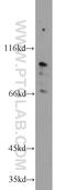 Transmembrane And Tetratricopeptide Repeat Containing 1 antibody, 23349-1-AP, Proteintech Group, Western Blot image 