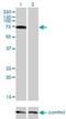 Protein Inhibitor Of Activated STAT 2 antibody, H00009063-M01, Novus Biologicals, Western Blot image 