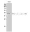 Olfactory Receptor Family 10 Subfamily Z Member 1 antibody, A17739, Boster Biological Technology, Western Blot image 