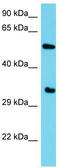 Armadillo Like Helical Domain Containing 1 antibody, TA334858, Origene, Western Blot image 