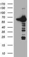 Cryptochrome Circadian Regulator 1 antibody, M00843, Boster Biological Technology, Western Blot image 