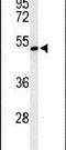 Zinc Finger DHHC-Type Containing 9 antibody, PA5-26721, Invitrogen Antibodies, Western Blot image 