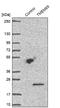 Transmembrane Protein 69 antibody, NBP1-90713, Novus Biologicals, Western Blot image 