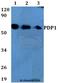 Pyruvate Dehyrogenase Phosphatase Catalytic Subunit 1 antibody, A05607, Boster Biological Technology, Western Blot image 