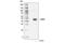 Absent In Melanoma 2 antibody, 63660S, Cell Signaling Technology, Western Blot image 