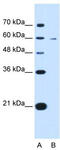 Kynureninase antibody, TA338980, Origene, Western Blot image 