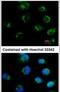 Glutamate Metabotropic Receptor 6 antibody, PA5-28770, Invitrogen Antibodies, Immunofluorescence image 