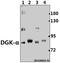 Diacylglycerol Kinase Alpha antibody, A06354-1, Boster Biological Technology, Western Blot image 