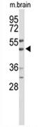 WD Repeat Domain, Phosphoinositide Interacting 2 antibody, AP54567PU-N, Origene, Western Blot image 
