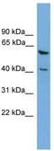 PIN2 (TERF1) Interacting Telomerase Inhibitor 1 antibody, TA344955, Origene, Western Blot image 