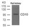 Membrane Metalloendopeptidase antibody, 79-682, ProSci, Western Blot image 