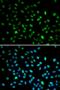 DNA Nucleotidylexotransferase antibody, orb378037, Biorbyt, Immunofluorescence image 