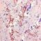 Aspergillus species antibody, MCA2576, Bio-Rad (formerly AbD Serotec) , Immunohistochemistry paraffin image 