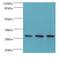 Origin Recognition Complex Subunit 6 antibody, LS-C380281, Lifespan Biosciences, Western Blot image 