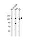 AXL Receptor Tyrosine Kinase antibody, M00226, Boster Biological Technology, Western Blot image 