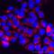 Transient Receptor Potential Cation Channel Subfamily M Member 7 antibody, LS-C95169, Lifespan Biosciences, Immunofluorescence image 