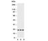 Fibroblast Growth Factor 21 antibody, R30758, NSJ Bioreagents, Western Blot image 