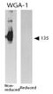 Selectin P antibody, 50122, QED Bioscience, Immunohistochemistry frozen image 