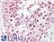 Casein Kinase 2 Alpha 1 antibody, LS-B7844, Lifespan Biosciences, Immunohistochemistry paraffin image 
