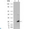 Crystallin Alpha B antibody, LS-C813967, Lifespan Biosciences, Immunohistochemistry paraffin image 