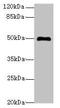 Adenosine Deaminase Like antibody, MBS7000914, MyBioSource, Western Blot image 