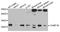 Charged Multivesicular Body Protein 1B antibody, A8239, ABclonal Technology, Western Blot image 