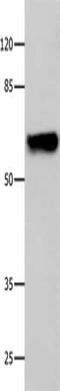 Cyclic Nucleotide Gated Channel Alpha 2 antibody, CSB-PA599265, Cusabio, Western Blot image 