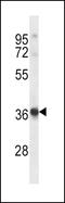 Histamine Receptor H2 antibody, LS-C165016, Lifespan Biosciences, Western Blot image 