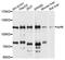 Aryl Hydrocarbon Receptor antibody, A1451, ABclonal Technology, Western Blot image 