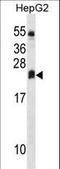 Dehydrogenase/Reductase 4 Like 2 antibody, LS-C159457, Lifespan Biosciences, Western Blot image 